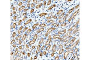 IHC analysis of SLC12A1 using anti-SLC12A1 antibody (ABIN3043925).