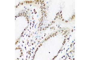 Immunohistochemistry of paraffin-embedded human stomach using Ku80 antibody (ABIN6130932, ABIN6150308, ABIN6150310 and ABIN6217336) at dilution of 1:100 (40x lens). (XRCC5 Antikörper  (AA 540-732))