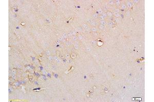 Immunohistochemistry (Paraffin-embedded Sections) (IHC (p)) image for anti-Solute Carrier Family 5 (Sodium/glucose Cotransporter), Member 1 (SLC5A1) (AA 401-500) antibody (ABIN738066)