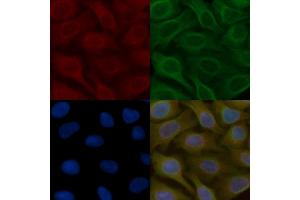 ARHGAP42 Mouse Monoclonal Antibody staining Hela cells by IF/ICC. (ARHGAP42 Antikörper  (Internal Region))