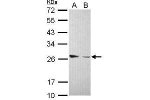 WB Image Sample (30 ug of whole cell lysate) A: IMR32 B: U87-MG 12% SDS PAGE antibody diluted at 1:1000 (Amphiregulin Antikörper)