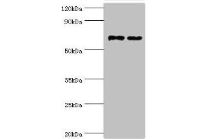 Western blot All lanes: Myotubularin-related protein 14 antibody at 10 μg/mL Lane 1: Hela whole cell lysate Lane 2: Mouse skeletal muscle tissue Secondary Goat polyclonal to rabbit IgG at 1/10000 dilution Predicted band size: 73, 67, 61 kDa Observed band size: 73 kDa (MTMR14 Antikörper  (AA 1-280))