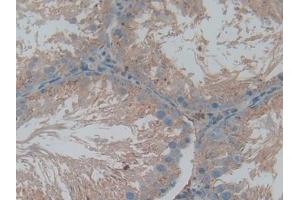 Immunohistochemistry (IHC) image for anti-Cathepsin L1 (CTSL1) (AA 114-288) antibody (ABIN7431587)