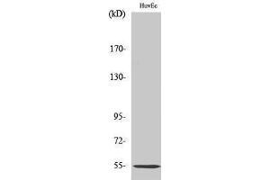 Western Blotting (WB) image for anti-Serpin Peptidase Inhibitor, Clade G (C1 Inhibitor), Member 1 (SERPING1) (Internal Region) antibody (ABIN3183585) (SERPING1 Antikörper  (Internal Region))