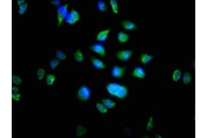 Immunofluorescence staining of Hela cells with ABIN7162762 at 1:100, counter-stained with DAPI. (MTRF1 Antikörper  (AA 285-433))