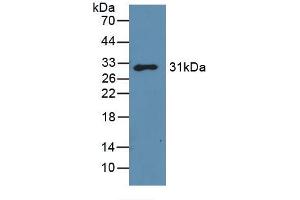 Western blot analysis of recombinant Mouse GAL3. (Galectin 3 Antikörper  (AA 2-264))