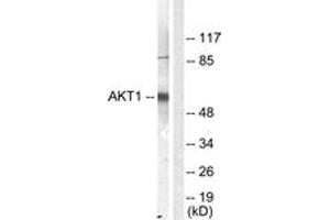 Western blot analysis of extracts from NIH-3T3 cells, treated with Serum 10% 30', using Akt (Ab-450) Antibody. (AKT1 Antikörper  (AA 416-465))
