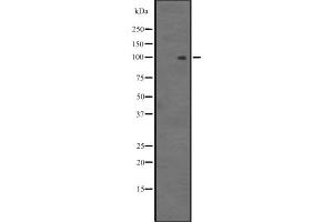 Western blot analysis of MYOCD expression in HEK293 cells ,The lane on the left is treated with the antigen-specific peptide. (Myocardin Antikörper  (Internal Region))