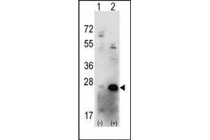 Western blot analysis of CSNK2B (arrow) using rabbit polyclonal CSNK2B Antibody