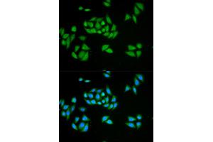 Immunofluorescence analysis of HeLa cells using UPF1 antibody. (RENT1/UPF1 Antikörper)