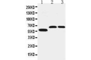 Anti-SLC1A4 antibody, Western blotting Lane 1: U87 Cell Lysate Lane 2: Rat Brain Tissue Lysate Lane 3: Mouse Brain Tissue Lysate (SLC1A4 Antikörper  (C-Term))