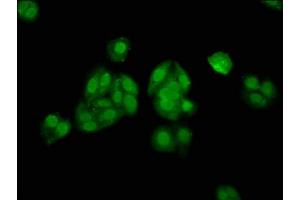Immunofluorescence staining of HepG2 cells with ABIN7155641 at 1:133, counter-stained with DAPI. (ALX3 Antikörper  (AA 11-127))