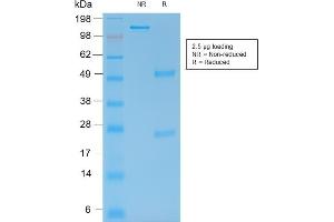 SDS-PAGE (SDS) image for anti-Matrix Metallopeptidase 9 (Gelatinase B, 92kDa Gelatinase, 92kDa Type IV Collagenase) (MMP9) antibody (ABIN6940075)