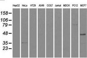 Western blot analysis of extracts (35 µg) from 9 different cell lines by using anti-CD4 monoclonal antibody. (CD4 Antikörper)