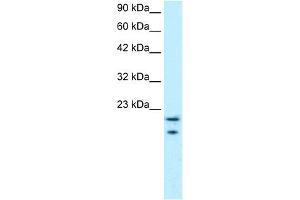 WB Suggested Anti-MYCBP Antibody Titration: 0. (MYCBP Antikörper  (Middle Region))