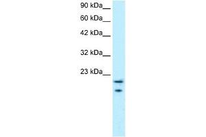 WB Suggested Anti-MYCBP Antibody Titration: 0.