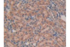 Immunohistochemistry (IHC) image for anti-R-Spondin 1 (RSPO1) (AA 136-262) antibody (ABIN7437200)