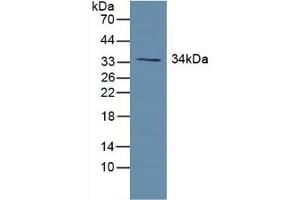 Western blot analysis of Human Lung Tissue. (Growth Hormone Receptor Antikörper  (AA 315-574))