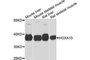 Western blot analysis of extracts of various cells, using HOXA13 antibody. (HOXA13 Antikörper)