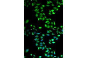 Immunofluorescence analysis of HeLa cells using PDCD6 antibody (ABIN5974030). (PDCD6 Antikörper)