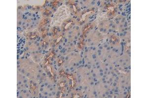 IHC-P analysis of kidney tissue, with DAB staining. (ABCC6 Antikörper  (AA 1260-1498))