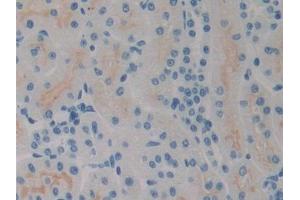 IHC-P analysis of Rat Kidney Tissue, with DAB staining. (SPRY2 Antikörper  (AA 116-304))