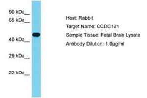 Image no. 1 for anti-Coiled-Coil Domain Containing 121 (CCDC121) (AA 197-246) antibody (ABIN6750672) (CCDC121 Antikörper  (AA 197-246))