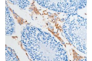 ABIN6255391 and ABIN6267252 at 1/100 staining rat testicular tissue sections by IHC-P. (CHEK2 Antikörper  (pSer516))