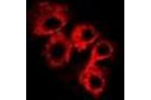 Immunofluorescent analysis of C4BP beta staining in Hela cells. (C4BPB Antikörper)