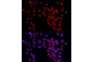 Immunofluorescence analysis of HeLa cells using YE Rabbit pAb (ABIN6130808, ABIN6150331, ABIN6150332 and ABIN6221925) at dilution of 1:50 (40x lens). (GAS41 Antikörper  (AA 1-227))