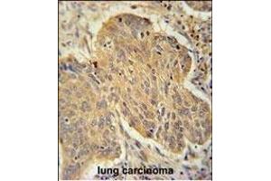 Immunohistochemistry (Paraffin-embedded Sections) (IHC (p)) image for anti-Proteasome (Prosome, Macropain) 26S Subunit, Non-ATPase, 7 (PSMD7) (AA 267-295), (C-Term) antibody (ABIN650763)