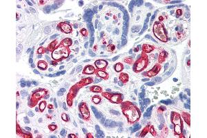 Anti-CD34 antibody IHC of human placenta. (CD34 Antikörper)
