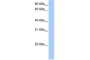 WB Suggested Anti-CTBP2 Antibody Titration:  0. (CTBP2 Antikörper  (C-Term))