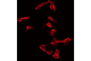 ABIN6267376 staining NIH-3T3 by IF/ICC. (Glycogen Synthase 1 Antikörper  (pSer645))