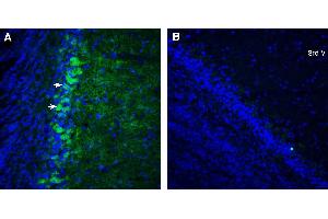 Expression of CXCR7 in mouse olfactory bulb.