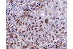 ABIN6266946 at 1/100 staining human lung tissue sections by IHC-P. (CDKL4 Antikörper  (Internal Region))