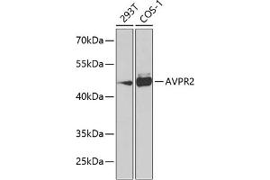 Western blot analysis of extracts of various cell lines, using  Antibody (ABIN6129564, ABIN6137379, ABIN6137380 and ABIN6223862) at 1:1000 dilution.