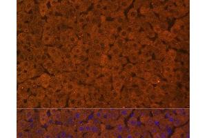 Immunofluorescence analysis of Rat liver using UGT1A1 Polyclonal Antibody at dilution of 1:100.