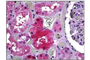 Immunohistochemistry (IHC) image for anti-Galactose-1-Phosphate Uridylyltransferase (GALT) antibody (ABIN781864) (GALT Antikörper)