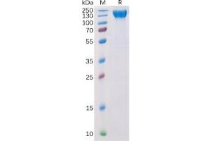 Human VEGFR2 Protein, His Tag on SDS-PAGE under reducing condition. (VEGFR2/CD309 Protein (His tag))