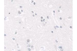 Detection of LMNB1 in Human Cerebrum Tissue using Polyclonal Antibody to Lamin B1 (LMNB1) (Lamin B1 Antikörper  (AA 52-233))