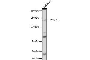 Western blot analysis of extracts of Rat brain, using Matrin 3 Rabbit mAb (ABIN7268414) at 1:1000 dilution. (MATR3 Antikörper)