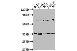 Western Blot Positive WB detected in: Hela whole cell lysate, HepG2 whole cell lysate, 293T whole cell lysate, Jurkat whole cell lysate, 293 whole cell lysate All lanes: MFF antibody at 1:1000 Secondary Goat polyclonal to rabbit IgG at 1/50000 dilution Predicted band size: 39, 33 28, 26 kDa Observed band size: 35 kDa (MFF Antikörper  (AA 1-322))
