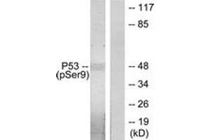 Western blot analysis of extracts from LOVO cells, using p53 (Phospho-Ser9) Antibody. (p53 Antikörper  (pSer9))