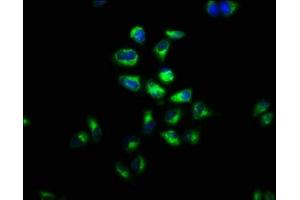 Immunofluorescence staining of Hela cells with ABIN7158126 at 1:100, counter-stained with DAPI.