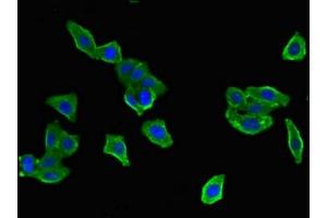 Immunofluorescent analysis of HepG2 cells using ABIN7150528 at dilution of 1:100 and Alexa Fluor 488-congugated AffiniPure Goat Anti-Rabbit IgG(H+L) (DNAJB6 Antikörper  (AA 208-326))