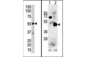 (LEFT) The PDK4 Antibody (C-term) is used in Western blot to detect PDK4 in mouse skeletal muscle tissue lysate. (PDK4 Antikörper  (C-Term))