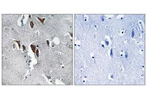 Immunohistochemistry (IHC) image for anti-ELOVL Fatty Acid Elongase 5 (ELOVL5) (C-Term) antibody (ABIN1851296) (ELOVL5 Antikörper  (C-Term))