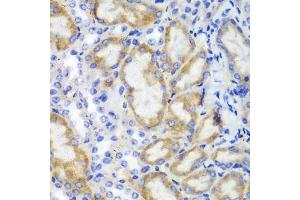 Immunohistochemistry of paraffin-embedded mouse kidney using HCLS1 antibody (ABIN3023093, ABIN3023094, ABIN3023095 and ABIN6219386) at dilution of 1:100 (40x lens). (HCLS1 Antikörper  (AA 1-280))