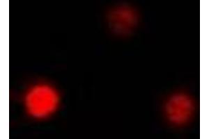 Immunofluorescent analysis of QKI staining in MCF7 cells. (QKI Antikörper)